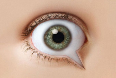 Desayuno de Pterigio